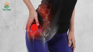 Các bài tập tốt cho người bị trật khớp háng