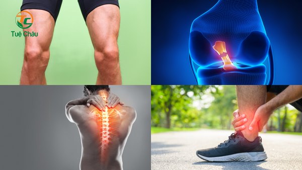 Chấn thương khi chơi cầu lông