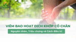 Viêm bao hoạt dịch khớp cổ chân và cách điều trị, phòng tránh