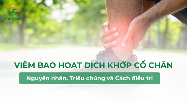 Viêm bao hoạt dịch khớp cổ chân và cách điều trị, phòng tránh
